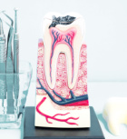 כל מה שרציתם לדעת על השתלות שיניים - ד"ר אריאל הירשהורן עונה-תמונה